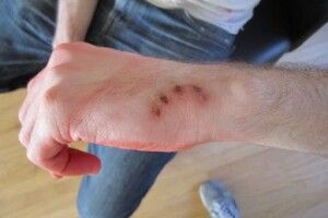 У відділенні «Нової пошти» жінка покусала чоловіка