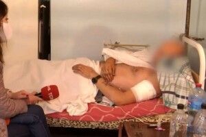 Все життя танцював: хореографу з Волині рятують кінцівки після поранень на Донеччині