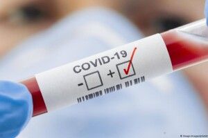 На Волині за тиждень зареєстрували 156 випадків захворювання на COVID  