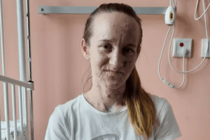 Втратили зір від поранень: мама і двоє дітей, постраждалі на Луганщині, знову можуть бачити (Фото)