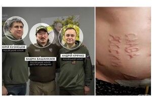 Встановили російських хірургів, які випалили «Слава россии» на тілі українського полоненого