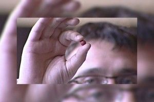 Невідомий прострелив ногу 20-річній дівчині, яка грала на скрипці