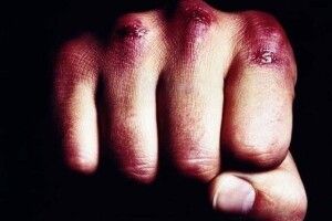 У Луцьку бились не до першої крові, а допоки не встане