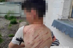 На Волині вітчим побив 13-річного пасинка гілкою, а мати – кропивою