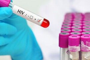  У Луцьку анонімно і безплатно тестуватимуть на гепатит та ВІЛ