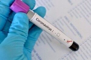 У Любомльській лікарні тестуватимуть на коронавірус методом ІФА