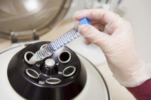 Волинянам радять остерігатись підступних інфекцій         