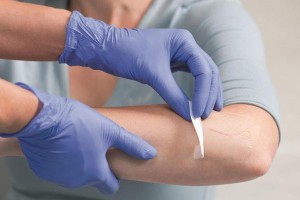 Вчені створили гель, що загоює рани без рубців