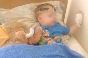 У якому стані дитина, яку збив працівник ТЦК на Одещині