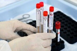 У Китаї вже п'ять днів поспіль не фіксують смертей від коронавірусу