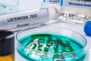 Не бачили 12 років: у хворого на Рівненщині знайшли небезпечну бактерію-вбивцю