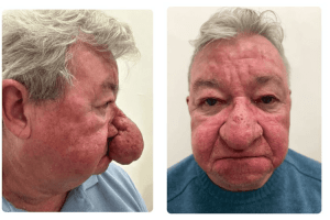 Не міг ні поцілуватися, ні навіть пива нормально випити…