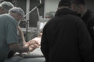 Допомагала мамі: 2-річна дівчинка залишилася без трьох пальців (Відео)