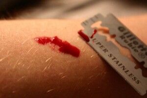 Порізала вени і виклала фото в соцмережі: у Луцьку 16-річна дівчина намагалася покінчити з життям