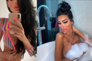 «Зараз у мене є імплантанти і силікон»: модель, яка зробила безліч маніпуляцій зі своєю зовнішністю, вирішила не зупинятися (Фото 18+)