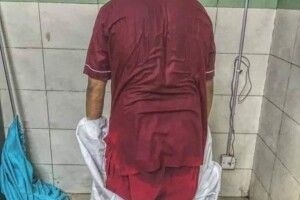 На підлозі спали дві медсестрички: пацієнтка розповіла про жахливі умови коронавірусної лікарні