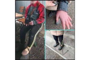 На Кіровоградщині жінка тримала на ланцюгу 17-річну дівчину з інвалідністю