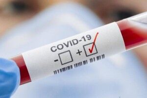 У МОЗ розповіли, яка наразі в Україні ситуація з коронавірусом