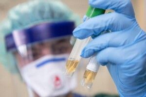 На Волині від COVID-19 померло 9 людей за добу, 325 заразилось