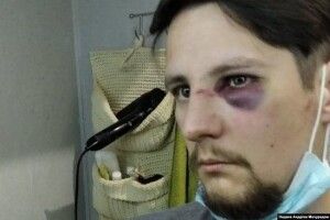 Поліцейському з Ковеля, який брав участь у побитті ветеранів АТО у Львові, повідомили про підозру в хуліганстві