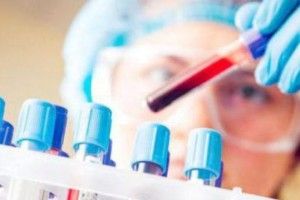 Мешканців громади запрошують на безкоштовну здачу аналізів