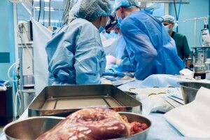 Першу на Закарпатті трансплантацію серця провели у Мукачеві