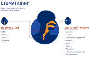 Як правильно полоскати горло при ангіні: використовуємо інструкцію Стоматидин® для процедури
