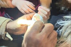 У Рівному рятувальники і медики звільняли палець 7-річної дитини