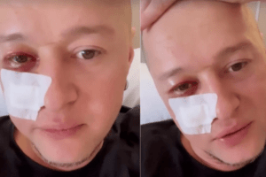 Лідер «Бумбоксу» Хливнюк розповів, що зробить з осколком міни, який поранив йому обличчя