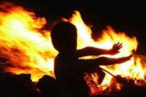 Дівчинка з Кореччини, яка впала у багаття, потребує допомоги