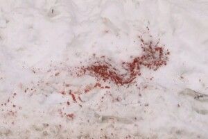 Жінка встромила ніж у спину чоловіку. Поліція її відпустила