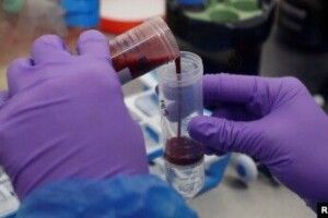 У Британії почали революційне випробування. Тест має визначати рак ще до симптомів