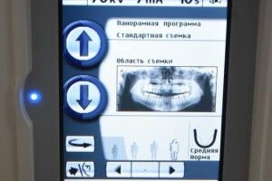 У луцькій стоматполіклініці крутий рентгенапарат (Фото)