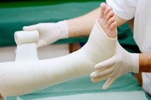 У Рівному злодій-рецидивіст зазнав «виробничої травми» – зламав ногу, коли вистрибував з вікна щойно «обчищеної» квартири 