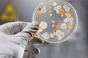 У Рівному зафіксували смерть від небезпечного інфекційного захворювання