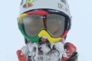 «Мій писок на 22-й годині пошуків»: гірський гід показав, як обморозив лице, шукаючи туриста на Закарпатті