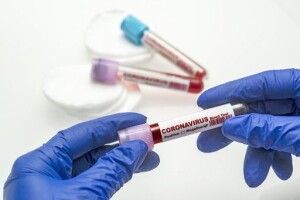 Тест на коронавірус: скільки коштує, де здати й за яких симптомів