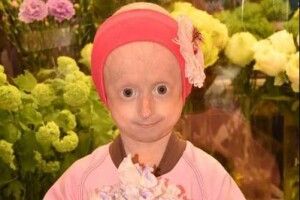 Не вдалося врятувати: на Вінниччині померла дівчинка з рідкісною хворобою (Фото)