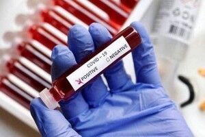 Коронавірус виявили у 59 жителів волинського міста 