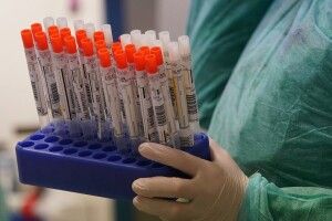 У найближчі три-чотири дні Україна перетне позначку в мільйон інфікованих COVID-19: протягом доби зареєстровано 8325 нових випадків