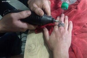 На Волині викликали рятувальників, щоб зняти каблучку з пальця