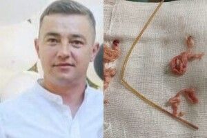 Злили всю кров, а температуру знизили до 18 градусів: лучанину зробили унікальну операцію на серці