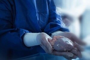 Лікар з Волині ініціював у Львові створення кафедри трансплантології