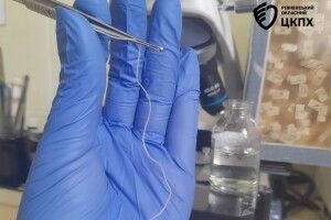 На Рівненщині з ока жінки видалили 11-сантиметрового паразита