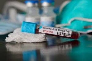 Троє лучан, які померли від ускладнень коронавірусу, мали супутні недуги