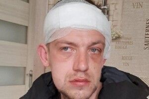 На Закарпатті група ромів жорстоко побила учасника АТО
