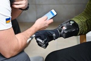 У Луцьку американські експерти ділитимуться досвідом із протезування 
