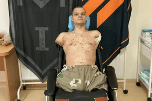 ПриватБанк покриє витрати на протезування ветерана після гучного скандалу в мережі (Відео)