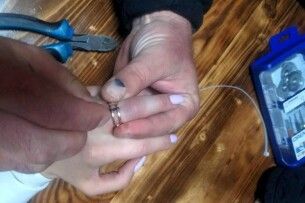На Волині рятувальники звільнили жінці палець