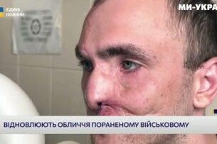 У Луцьку канадські лікарі повернули красу воїну, якому відірвало ніс (Відео)